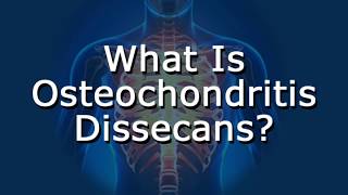 What Is Osteochondritis Dissecans [upl. by Nelehyram]