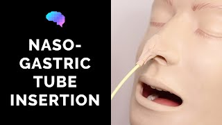 Nasogastric NG Tube Insertion  OSCE Guide  UKMLA  CPSA [upl. by Maiga321]