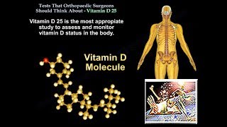 25 Vitamin D Tests Ortho Surgeons Think About Everything You Need To Know  Dr Nabil Ebraheim [upl. by Jutta]