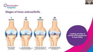 Benenden Hospital webinar Treatment for knee osteoarthritis [upl. by Link772]