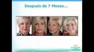 ¿Cómo rejuvenecer hasta 15 años en 90 días sin botox ni cirugía ComoRejuvenecer MásJovenEn15Min [upl. by Pachston]