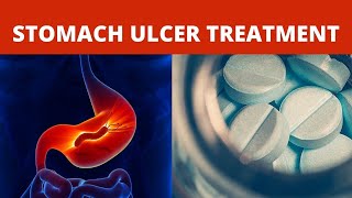 Stomach Ulcer Home Treatment  Licorice Root [upl. by Nylimaj]