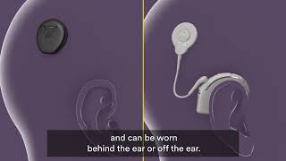 How Cochlear Implants Work [upl. by Milore615]