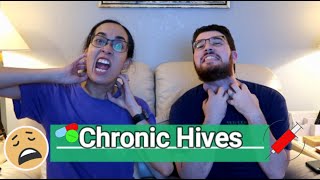 🤒Chronic Hives🌡  Understanding the condition🩺 [upl. by Airotnes865]