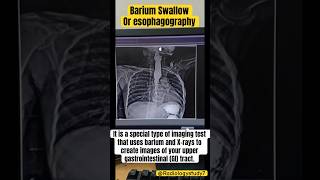 Barium Swallow procedure  Radiology success sigmarulessuccess shorts radiology medical xray [upl. by Jentoft]