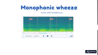 Lung sounds  monophonic wheeze [upl. by Anemij]