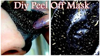 Remove Blackheads amp Whiteheads Easily At Home With DIY Peel Off Mask [upl. by Menzies]