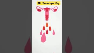 Uterine fibroids homeopathic treatment homeopathy shorts [upl. by Sams]