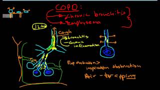 Pathophysiology of COPD [upl. by Aicilra]