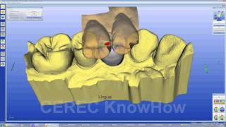 CEREC® Crown Multilayer  Crown  Software [upl. by Anirtac]