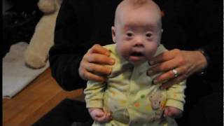 Down Syndrome in Occupational Therapy Take 1 [upl. by Navada]