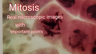 Mitosis  Real microscope image cell division with important points [upl. by Adorl]