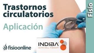 Falta de riego edema trombosis… Aplicación de INDIBA ACTIV en los trastornos circulatorios [upl. by Eerehs]