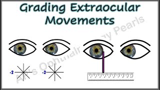 Grading Extraocular Movements [upl. by Finnegan]