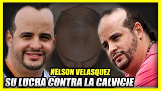 Historia de NELSON VELASQUEZ  Su lucha contra la calvicie [upl. by Aziram386]