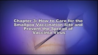 Chapter 3 How to Care for the Smallpox Vaccination Site and Prevent the Spread of Vaccinia Virus [upl. by Shyamal]