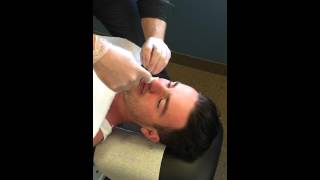 Nasal Specific Treatment  Procedure  Chiropractic Adjustment [upl. by Ihculo]