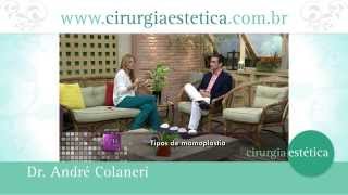 Tipos de Mamoplastia Mastopexia Redutora de Aumento Dr André Colaneri explica [upl. by Ayik]