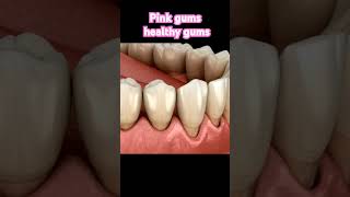 Healthy gumspink gums dentist youtubeshorts trending gulabisadi viralshort shortsfeed viral [upl. by Morse737]