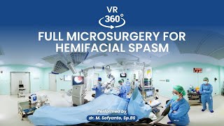 VR 360⁰ Micro Vascular Decompession MVD for Hemifacial Spasm by M Sofyanto Neurosurgeon [upl. by Cattan]