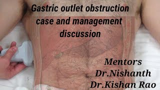 Gastric outlet obstruction due to carcinoma stomach case discussioncontinued [upl. by Dael614]