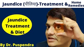 Jaundice पीलिया  Treatment amp Home Remedies  Jaundice Foods to Eat  Jaundice Symptoms [upl. by Haliled]