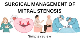 mitral stenosis  Percutaneous Transmitral commissurotomy balloon valvutomy mitral replacement [upl. by Raynata]