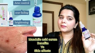 How to use Mandelic acid serum  mandelic acid serum review [upl. by Holden]