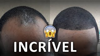 MAQUIAGEM CAPILAR INCRÍVEL NA BARBEARIA 😱 [upl. by Banna]