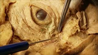 Palpebral and Lacrimal Apparatus Dissection – Clinical Demonstration – Sanjoy Sanyal [upl. by Oijile]