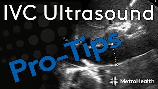 IVC Ultrasound ProTips [upl. by Sirama180]