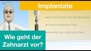 Implantate Erklärvideo [upl. by Diver]