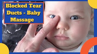 BABY BLOCKED TEAR DUCTS  Including massage video [upl. by Aihsit205]