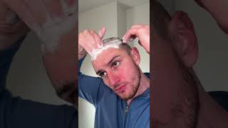 Keep falling in love hair hairtransformation hairtransplant hairwashday update buzzcut [upl. by Terrance41]