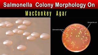 Salmonella Colony Morphology On MacConkey agar [upl. by Latsyc917]