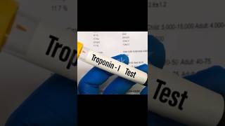 Mastering Cardiac Profiles Troponin Myoglobin and C Reactive Protein Levels medicaltest [upl. by Schroder576]