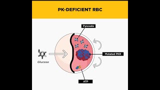 Phosphoglycerate Kinase Deficiency as a Disorder related to Glycolysis Pathway [upl. by Wimsatt]