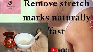 stretch mark removal homemade natural cream  natural ingredients  Skin care [upl. by Stead773]