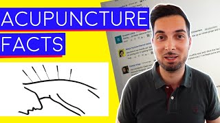 Acupuncture  What Is Acupuncture  How Does Acupuncture Work [upl. by Uwton]