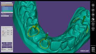 Form 3B  Solid Models with Working Dies in ExoCAD Model Creator [upl. by Noelc892]