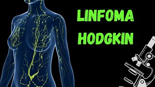 Linfoma Hodgkin [upl. by Letsyrhc]