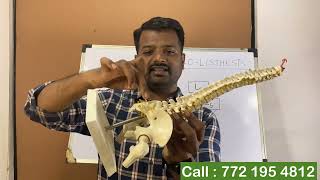 कमरेतील मणका सरकने  सायटीका  L4 over L5 amp L5 over S1 Spondylolisthesis  sciatica [upl. by Esorlatsyrc]