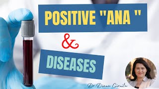 Positive ANA test antinuclear antibodies and autoimmune diseases [upl. by Gideon]