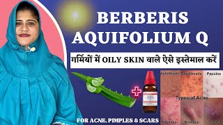 Berberis Aquifolium Q  Best Way to use for OILY SKIN in summers  Get glowing skin Instantly [upl. by Viddah185]