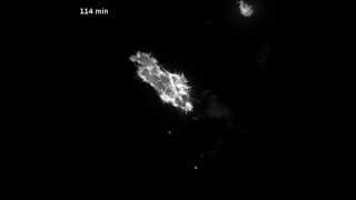 Mesenchymal movement during cancer cell invasion [upl. by Friedrick]