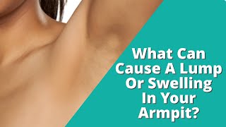 Ive Found A LUMP in My Armpit It Is PAINFUL Could This Be CANCER [upl. by Wilek]