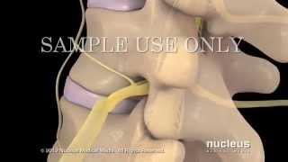 Examen Físico de Columna Lumbar en 5 minutos [upl. by Piks]