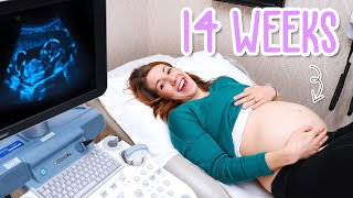 14 Week Pregnancy Ultrasound  Baby Moving and Yawning [upl. by Yecart]