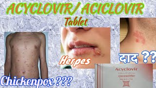 Acyclovir tablets  Herpikind  Herpikind Tablet  Zovirax  Zovirax tablets  uses side effects [upl. by Ardnosac]