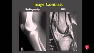 Medical Student Lecture Introduction to Musculoskeletal Imaging [upl. by Htebazila]